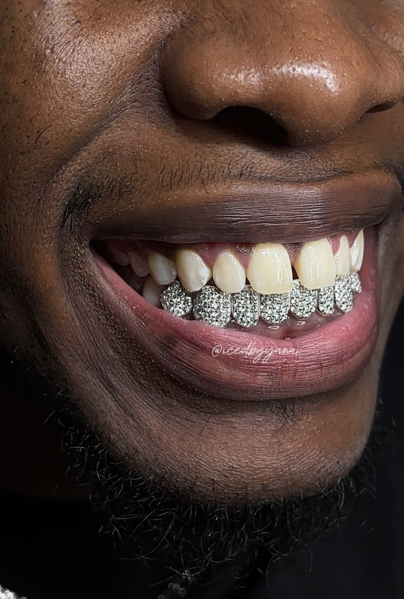 Fully iced diamond bottom grillz on a bold smile