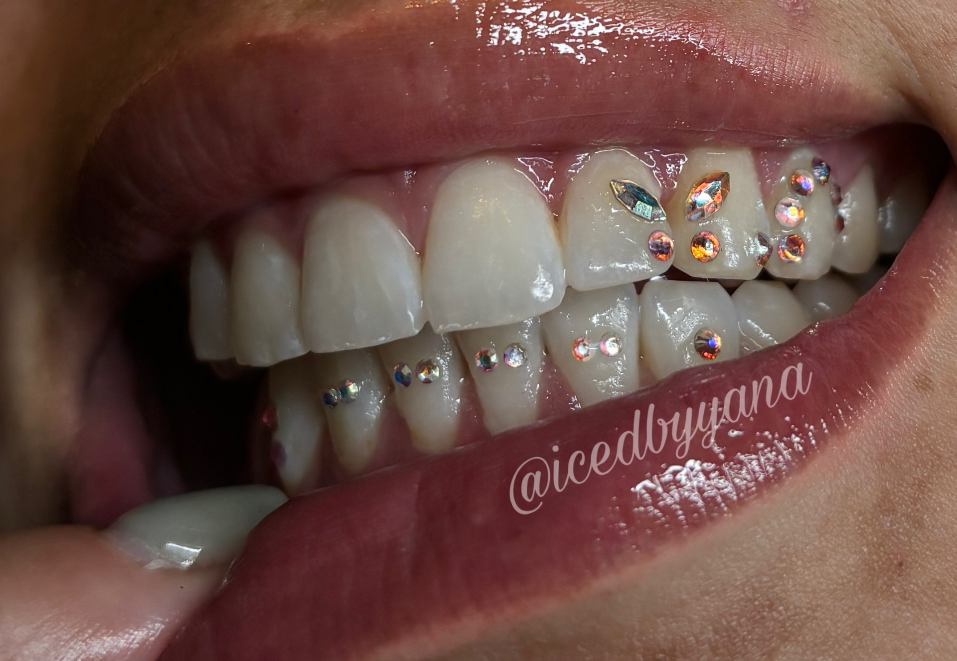 Full smile with dazzling aurora tooth gems top and bottom