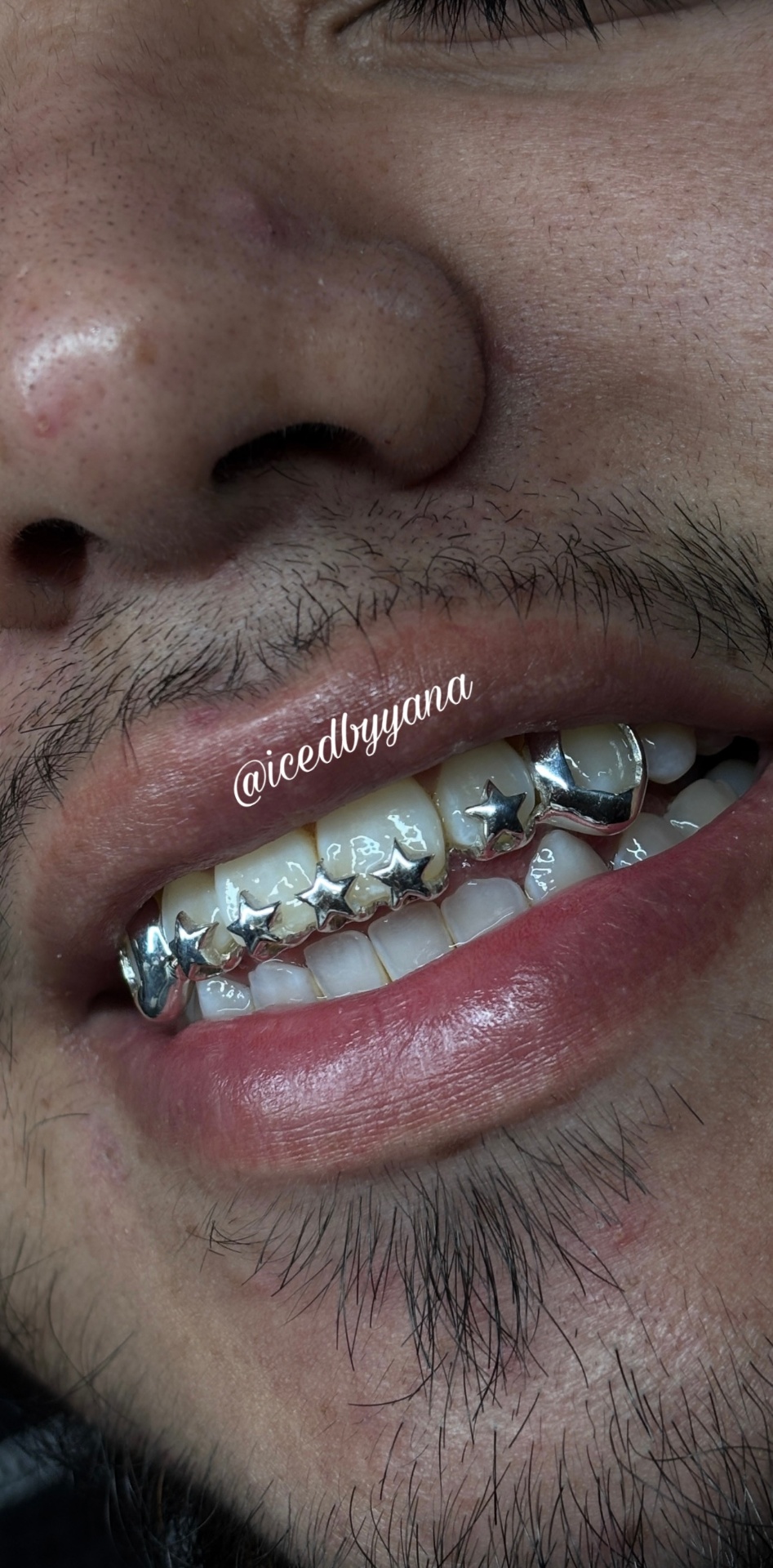 Sterling silver star cutout grillz top and bottom
