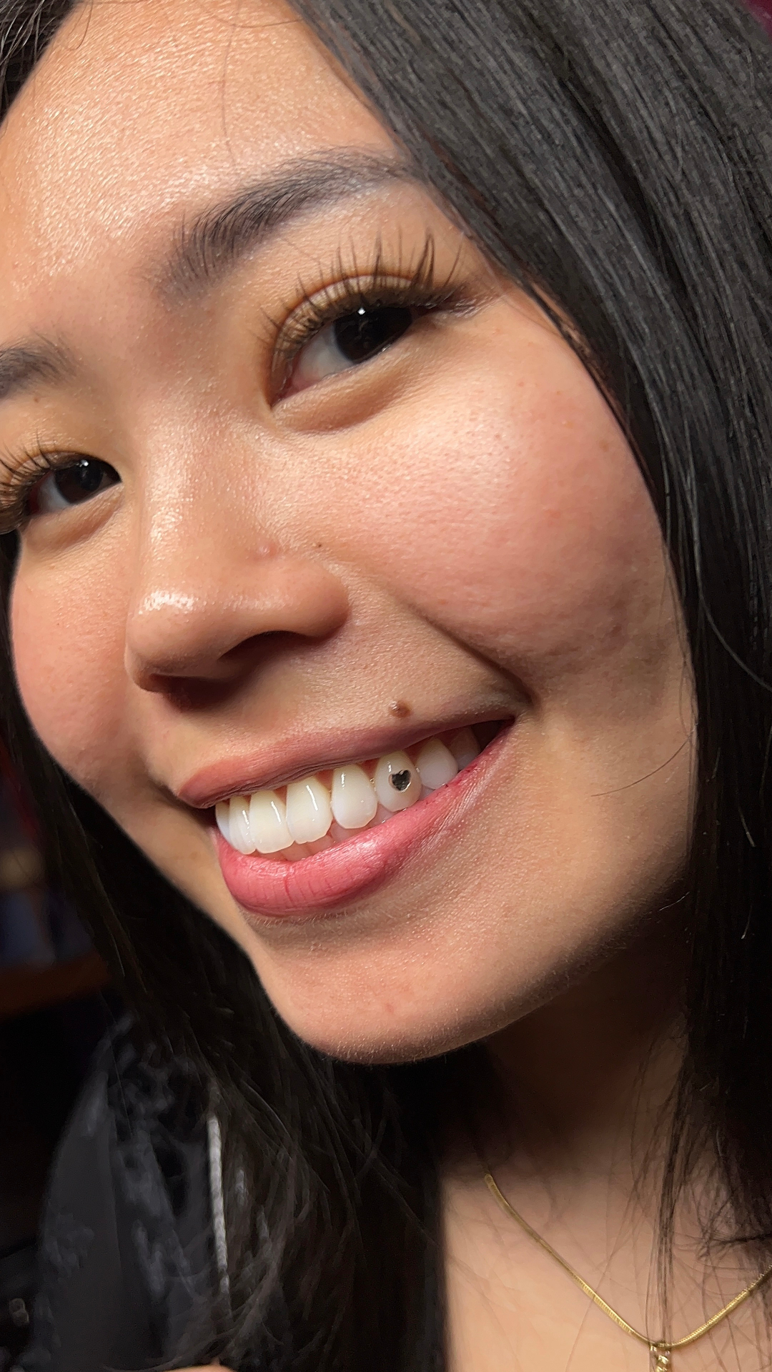 Single jet-black gem accent on a natural smile