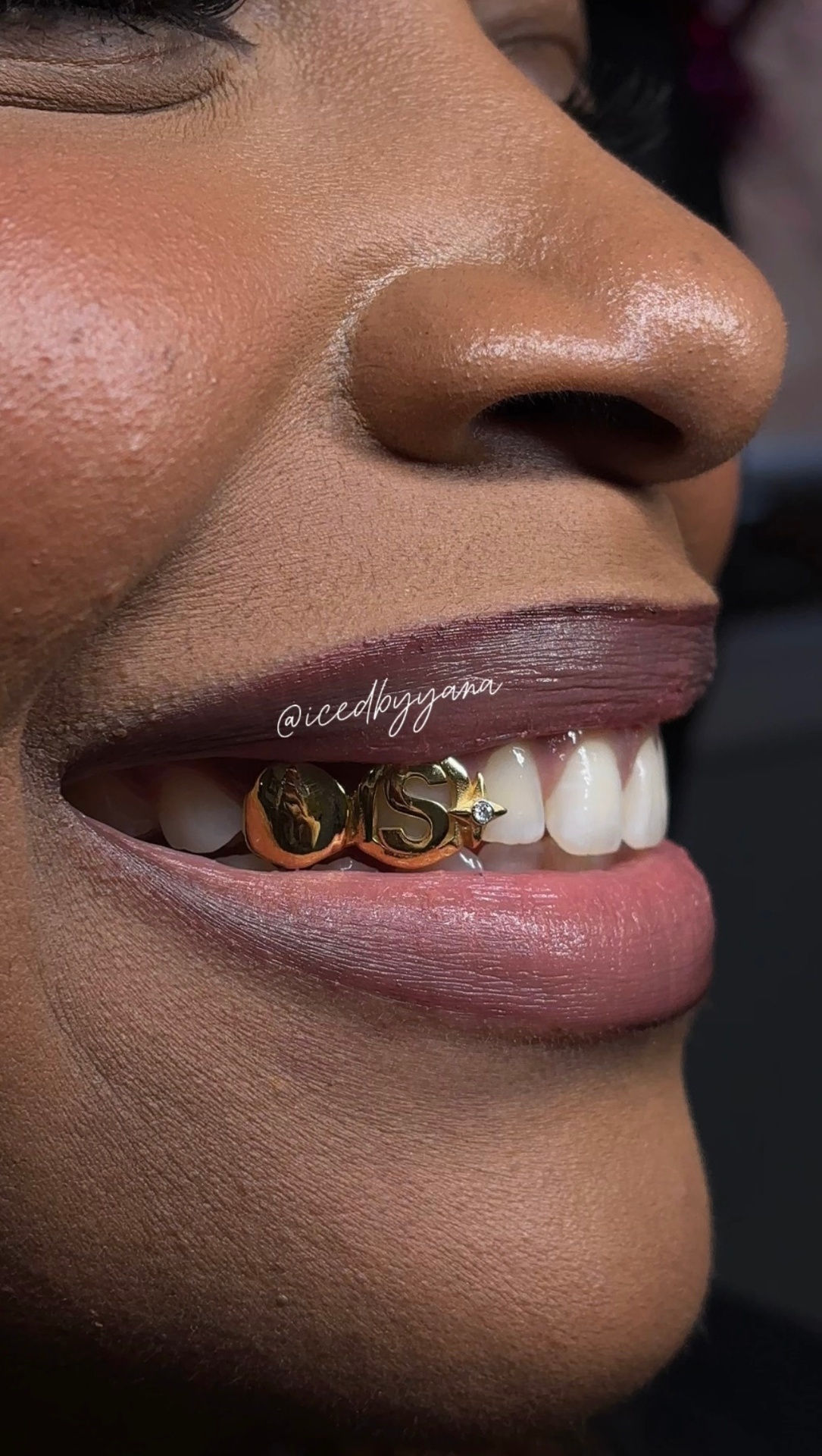 Custom gold initial grillz with diamond star accent