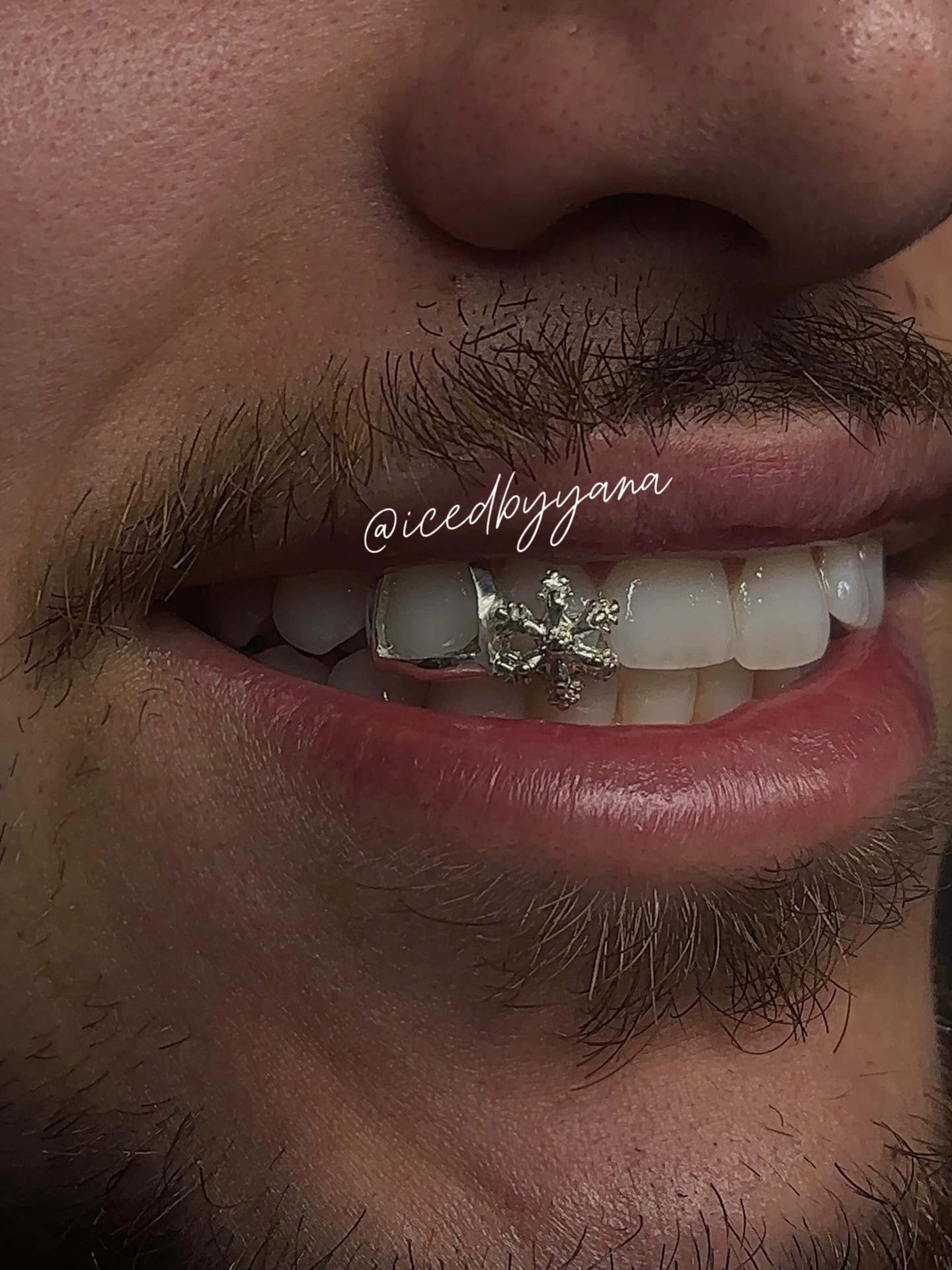 Silver open-face grill with cross detail