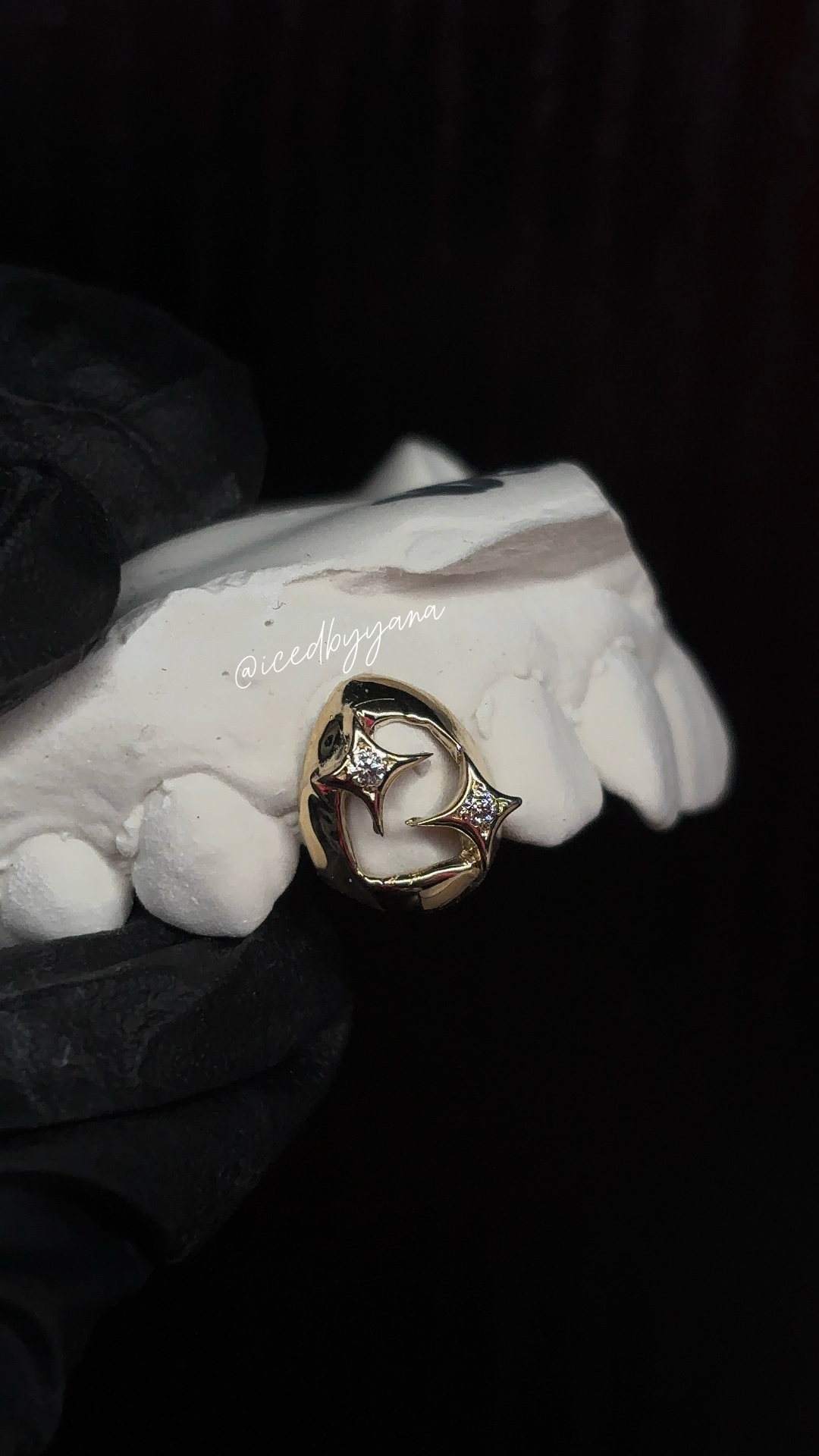 Gold open-face heart grill with diamond star accents on model