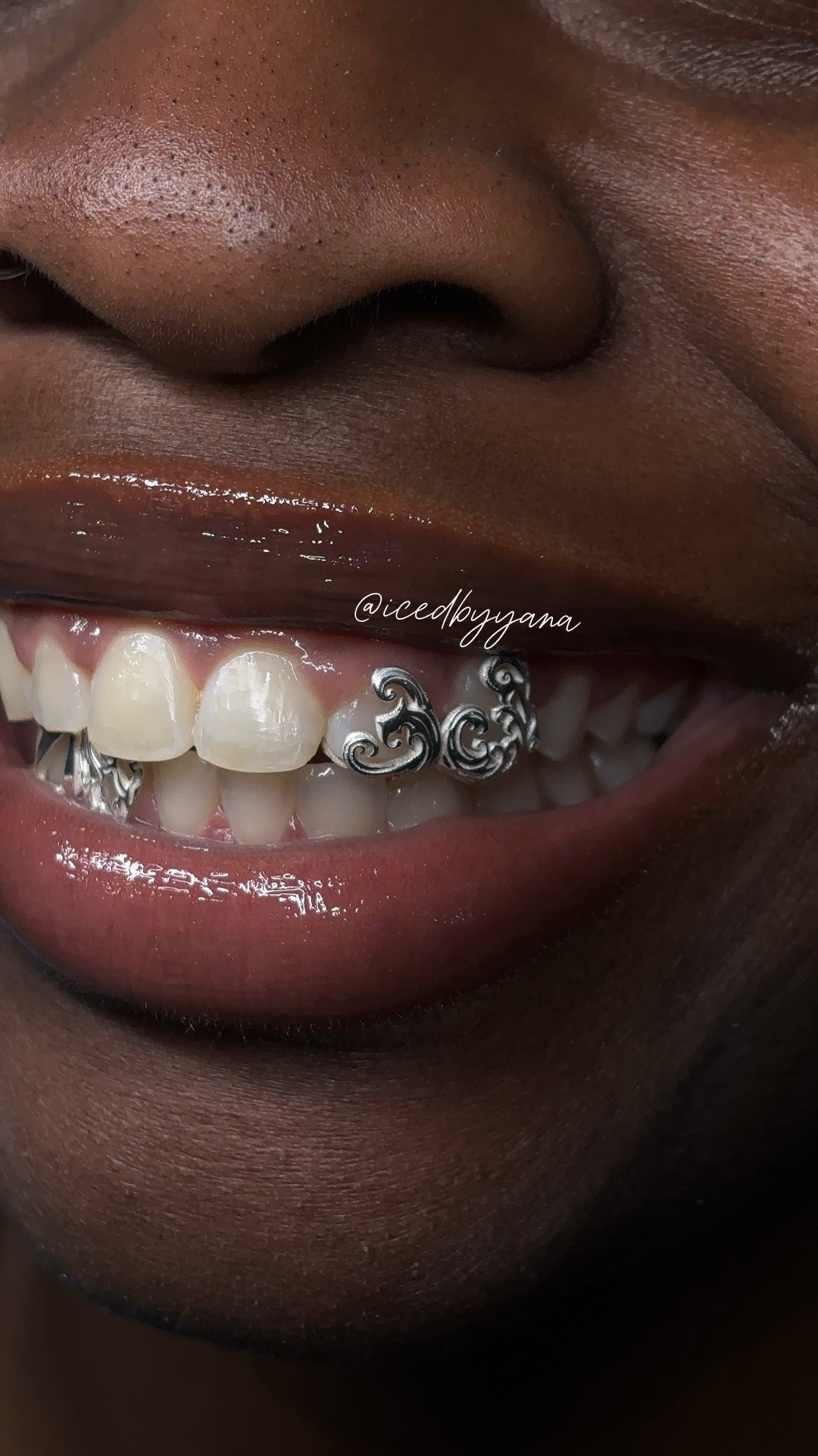 Sterling silver filigree open-face grillz close-up
