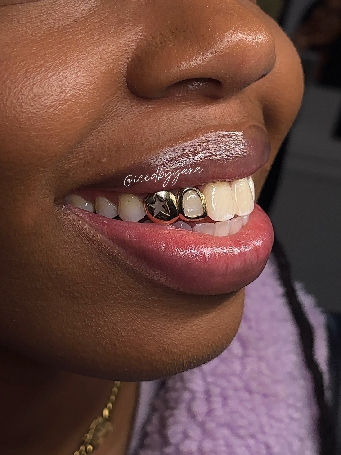 Two-tone gold star open-face grill