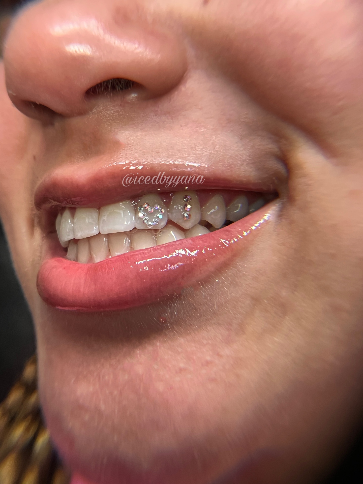 Delicate crystal cluster tooth gem on a fresh smile