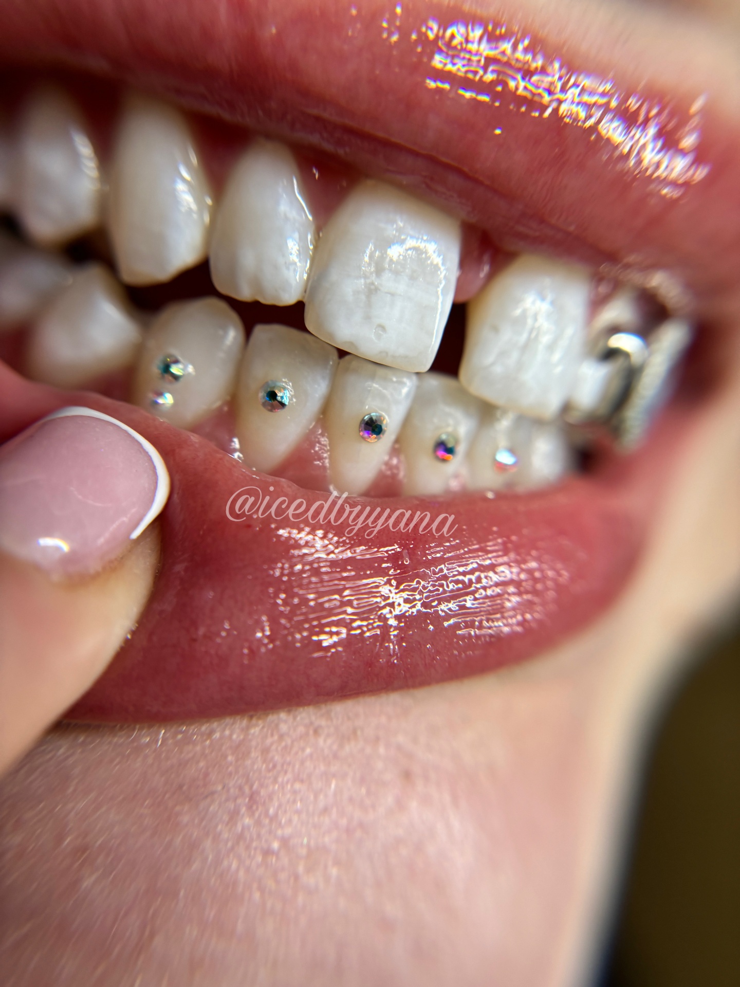 Iridescent tooth gems lined across a bottom smile